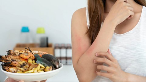 A woman wearing a white top has red skin on her right arm from itching and redness after eating sea food. Next to her on her left is a white bowl full of shellfish, including prawns and mussels