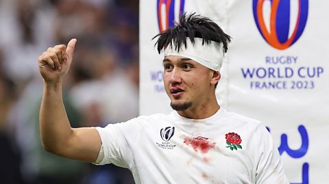 England's Marcus Smith gives a thumbs up with his right hand while wearing a bandage and a blood stained white jersey.