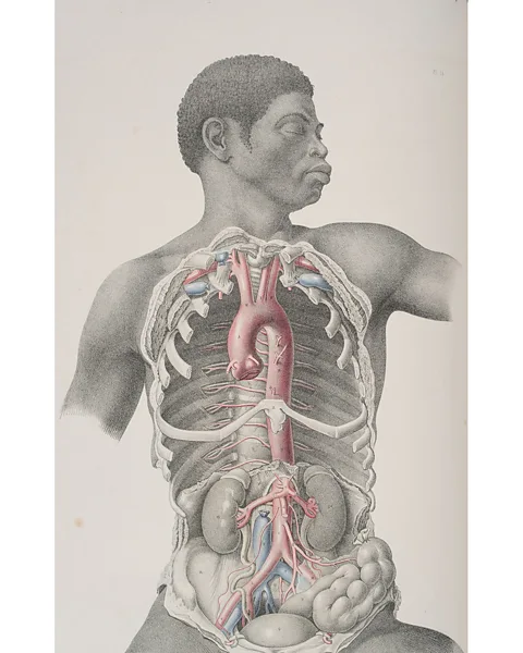 Mark Newton Photography The meticulous works of Maclise are included in an exhibition at the Thackray Museum of Medicine (Credit: Mark Newton Photography)