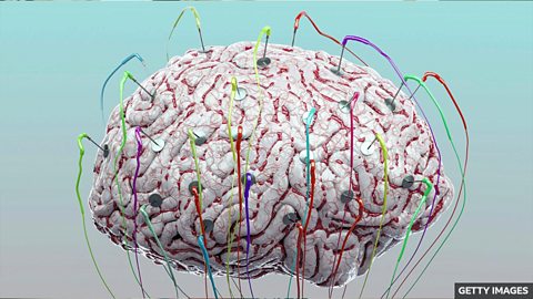 Could technology help kickstart the brain? 科技能帮助 “重启” 大脑吗？