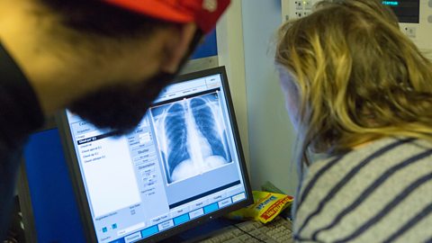 A female radiographer reviews a digital chest x-ray checking for abnormalities associated with tuberculosis (TB).
