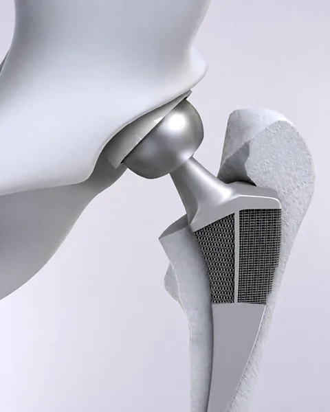 Amir A Zadpoor/ TU Delft Using metamaterials in hip implants could improve how they fit and help them to last longer (Credit: Amir A Zadpoor/ TU Delft)