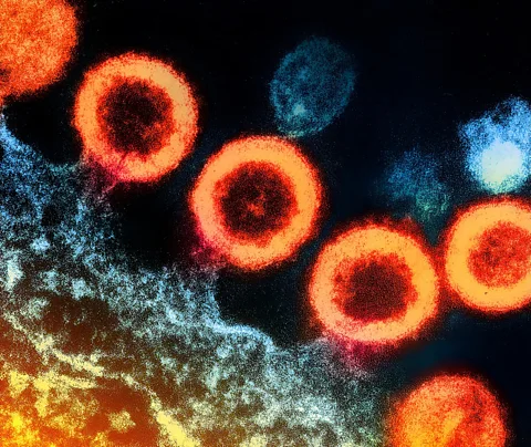 Getty Images HIV attacks the immune system cells, making it is hard for patients to fend it off naturally, but elite controllers have immune systems suited to the fight (Credit: Getty Images)