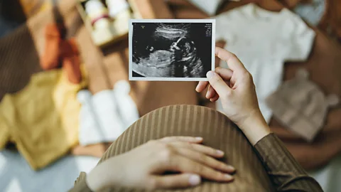Getty Images Point of view of a pregnant woman looking down at an ultrasound scan photo with one hand on her baby bump (Credit: Getty Images)