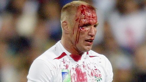 Neil Back the England flank forward ordered off by the ref with a head injury