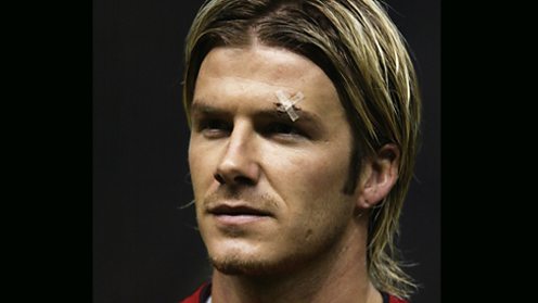 David Beckham with a cut eye after a clash with Sir Alex Ferguson.