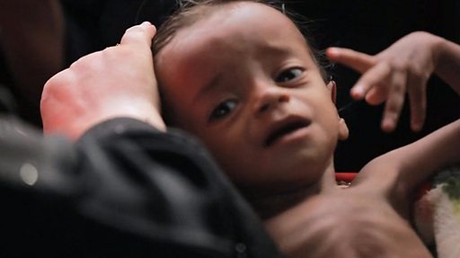 Coronavirus Voici Pourquoi La Pandemie Frappe Si Fortement Le Yemen c News Afrique