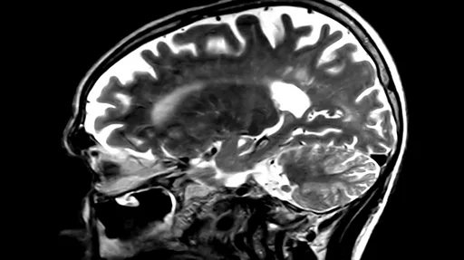 Saunadagi yalangoch qizlar Toychoq bilan jinsiy porno video