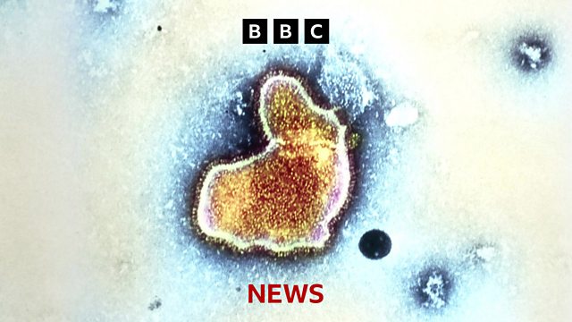 BBC - Winter Virus Jab Could Keep Babies Out Of Hospital