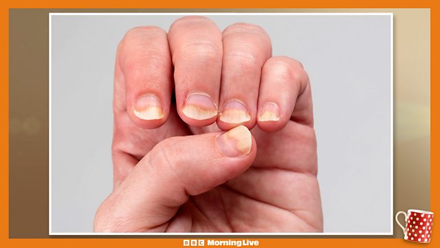 A Complete Guide to Nail Health for Strong, Healthy Nails | Mirra Skin –  MirraSkincare