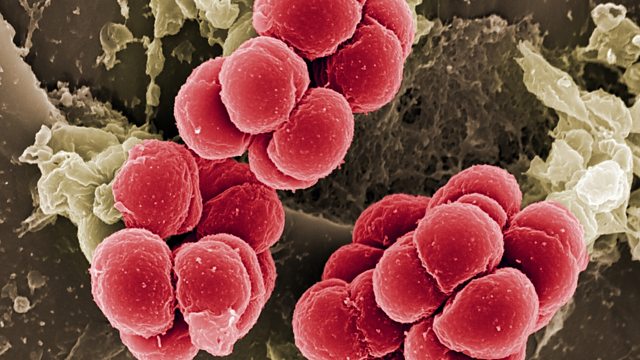 Staphylococcus aureus - Food safety – CCEA - GCSE Home Economics: Food ...