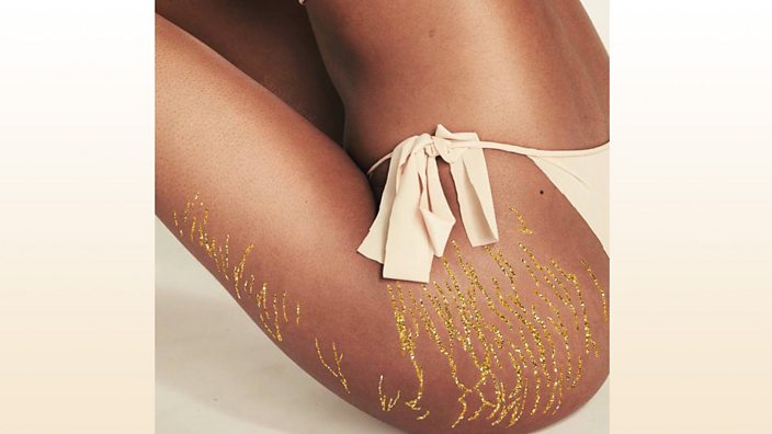 This artist is using glitter to turn stretch marks into art. 