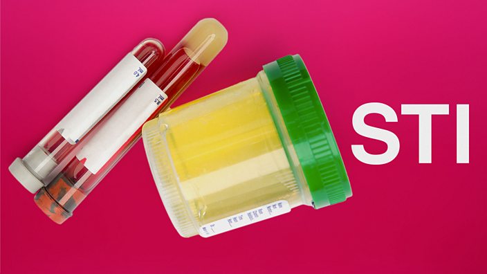 STIs