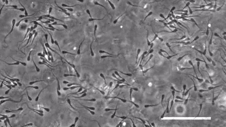 gelatin lumps in sperm