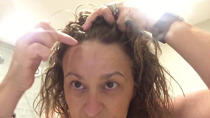 Loose Women S Nadia Shares Hair Loss Story