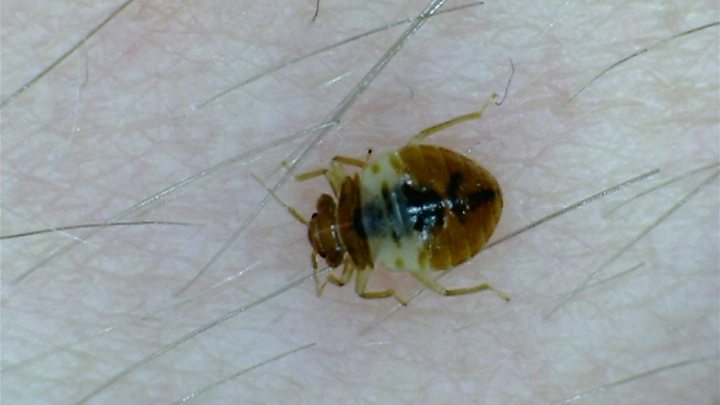 Bed bugs found in King’s College Hospital postnatal ward