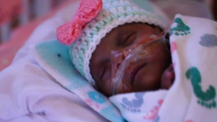 ‘World’s smallest’ surviving premature baby released from US hospital