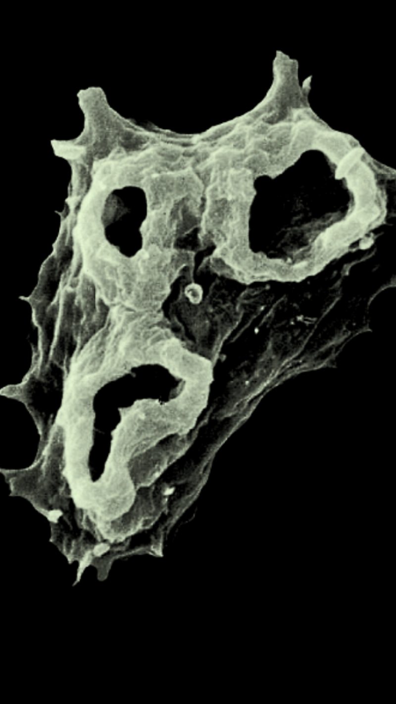 顯微鏡下的福氏耐格里原蟲（Naegleria fowleri）