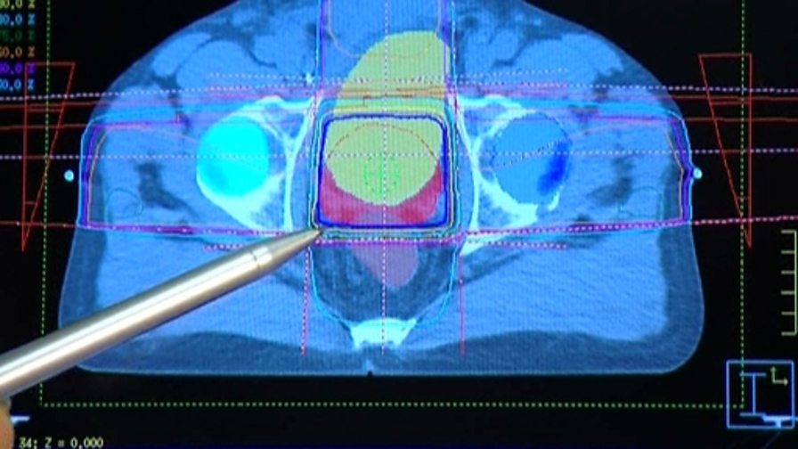 BBC Two Bitesize Secondary, Science 2 GCSE, Medical uses of Xrays