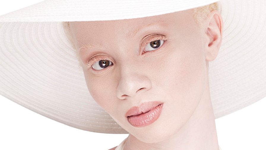 Bbc World Service Outlook Thando Hopa The South African Model With Albinism