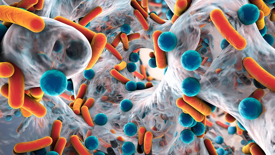 What would a world without antibiotics be like? - BBC Ideas