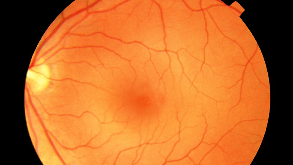 The eye Coordination and control The nervous system OCR Gateway