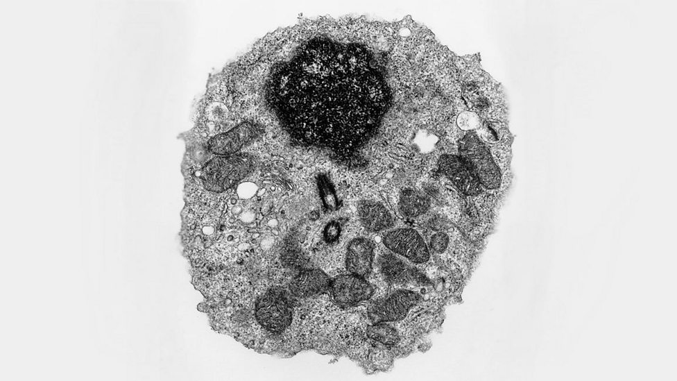 Electron microscopes Cell structure Edexcel GCSE Biology (Single