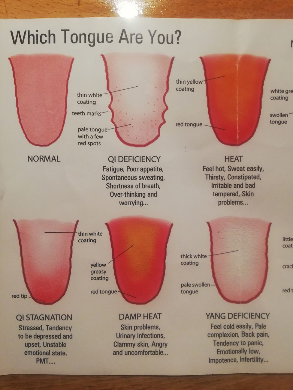 Stoke Chinese Medicine Tongue Chart