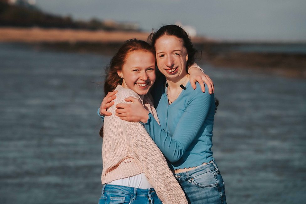 “Every deaf child is different” Top tips for talking to deaf people.