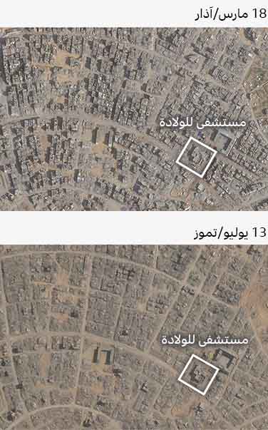 صورة مقارنة (قبل وبعد) لحي تل السلطان بتاريخي 10 مايو/أيار 2025 و4 يوليو/تموز 2025، ويظهر حجم الدمار لمعظم المباني في الصورة بعد التدمير، مع بقاء مستشفى الولادة قائماً دون تدمير.