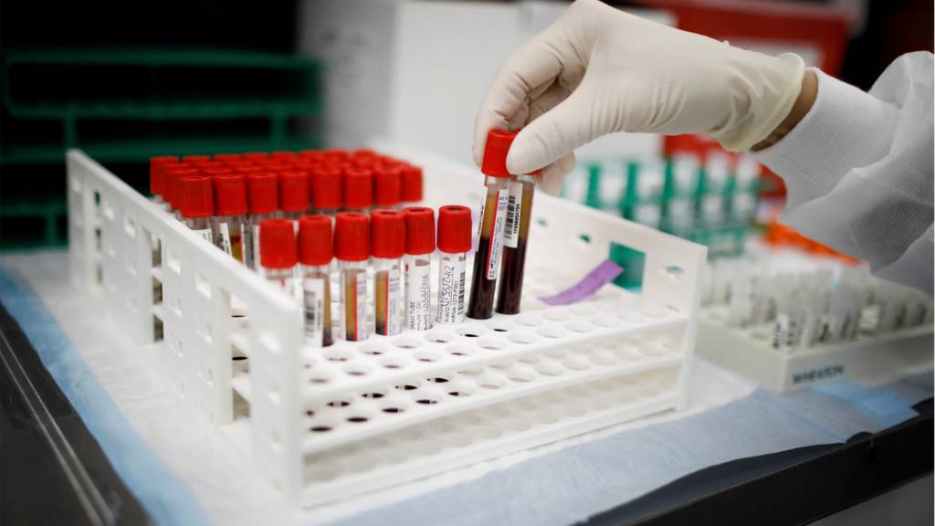A health worker takes test tubes with plasma and blood samples after a separation process in a centrifuge during a coronavirus disease (COVID-19) vaccination study at the Research Centers of America, in Hollywood, Florida, U.S., September 24, 2020.