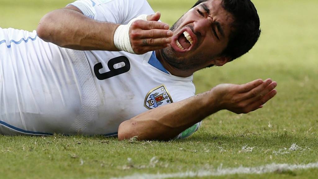 Luis Suarez following the bite he was banned for at the World Cup 2014