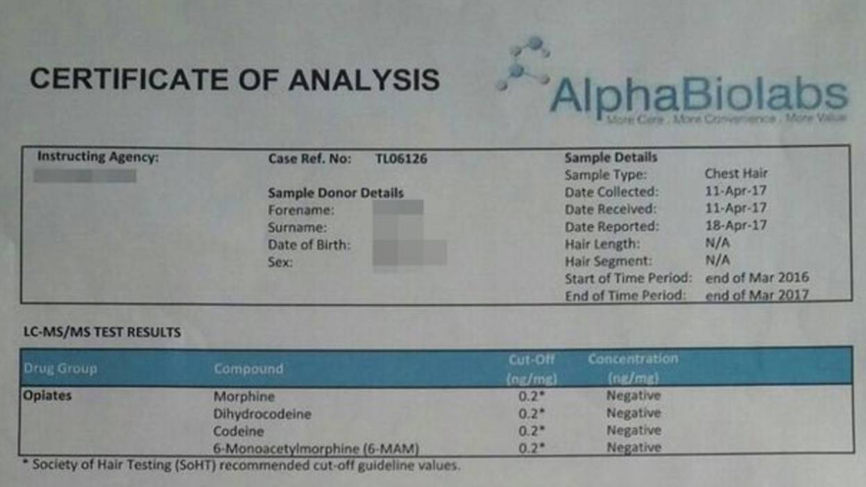 Hair Follicle Drug Test Results Chart