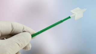 A gloved hand holding a gynaecological swab used in a smear test