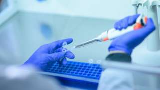 Lab testing