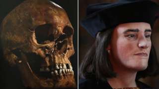 Richard III skull next to facial reconstruction