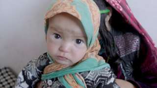 Baby on malnutrition ward in Ghor