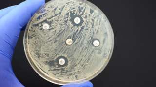 Pruebas en un recipiente conocido como placa de Petri para detectar bacterias resistentes