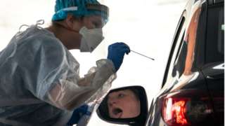 Prueba de PCR en Estados Unidos.