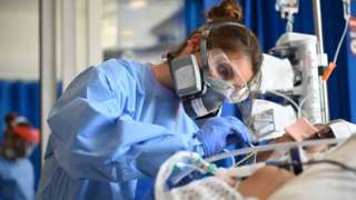 Staff care for a patient in critical care at Royal Papworth hospital in Cambridge