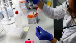 A laboratory worker works on fast PCR testing samples