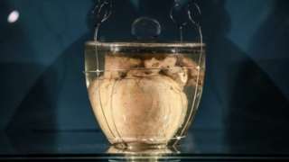 The heart of King Pedro IV of Portugal, also known as Dom Pedro I of Brazil (1798-1834) is on display for the first time at the Noble Hall of the Irmandade da Lapa in Porto, Portugal, 20 August 2022