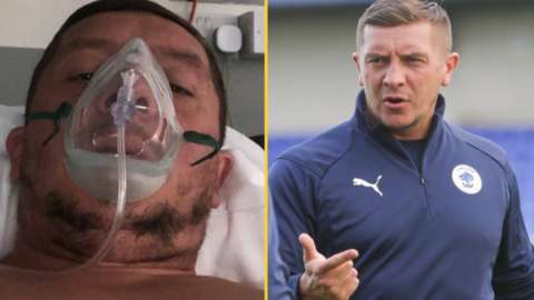 Anthony Johnson in Fairfield General Hospital, Bury, (left) and on the training pitch at Chester