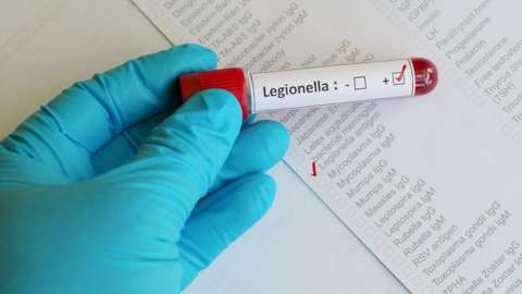 A test for Legionnaires' disease