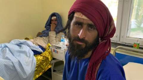 An Afghan man in hospital after an earthquake