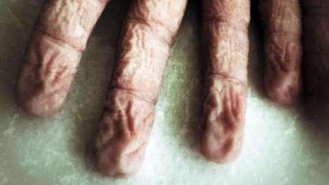 wrinkled fingers