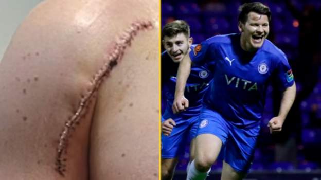FA Cup 2021-22: Stockport County's Connor Jennings on returning to action after cancer surgery