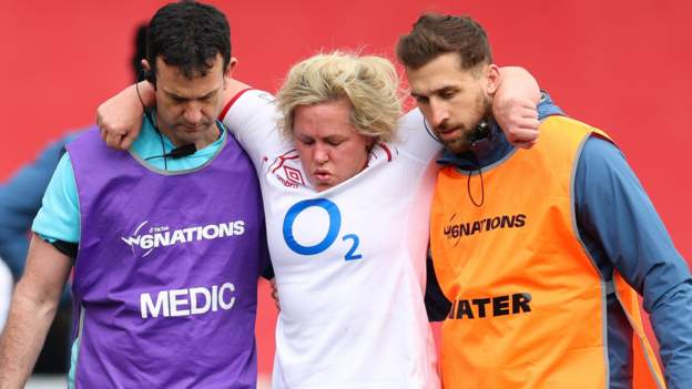 <div>Women's Six Nations: England hit by Marlie Packer and Hannah Botterman injuries</div>