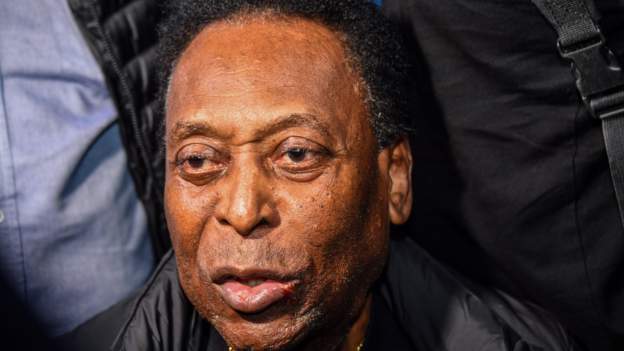 Pele: Brazil legend, 80, has surgery to remove tumour