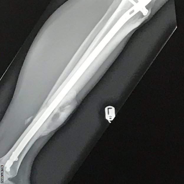 x-ray